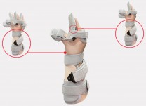 Dynamic functional hand and forearm AM-SDP-K-01 Dynamic functional hand and forearm AM-SDP-K-01