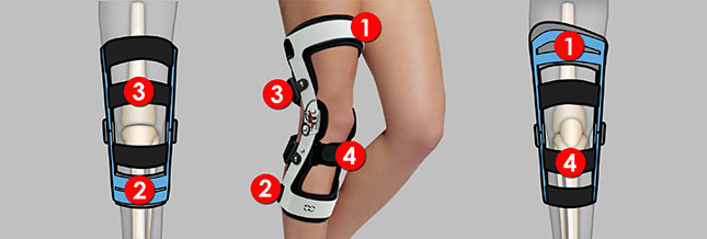 The 4-point orthoses