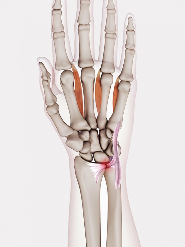 forearm pain when lifting