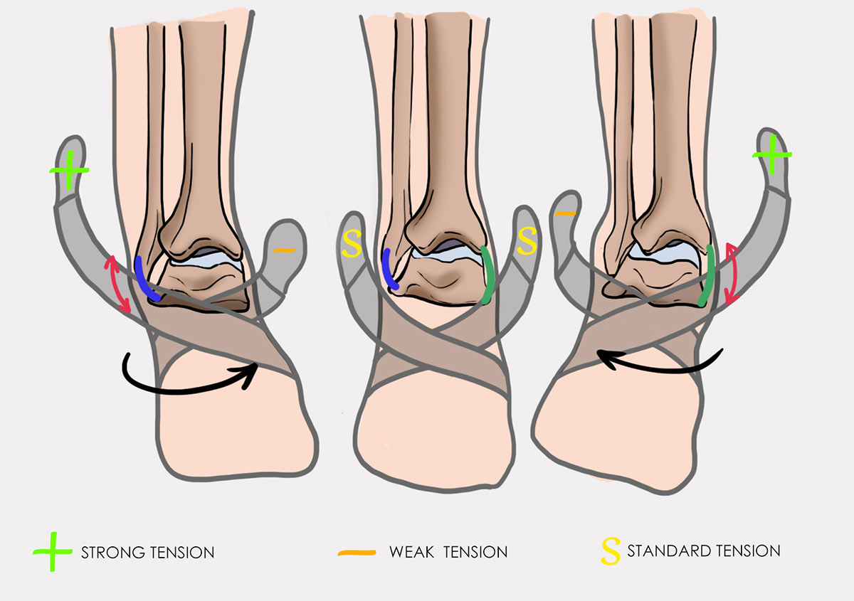 Ankle support AM-OSS-05  Reh4Mat – lower limb orthosis and braces -  Manufacturer of modern orthopaedic devices