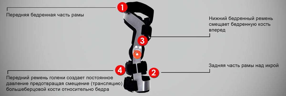 Вальгусная деформация стопы у