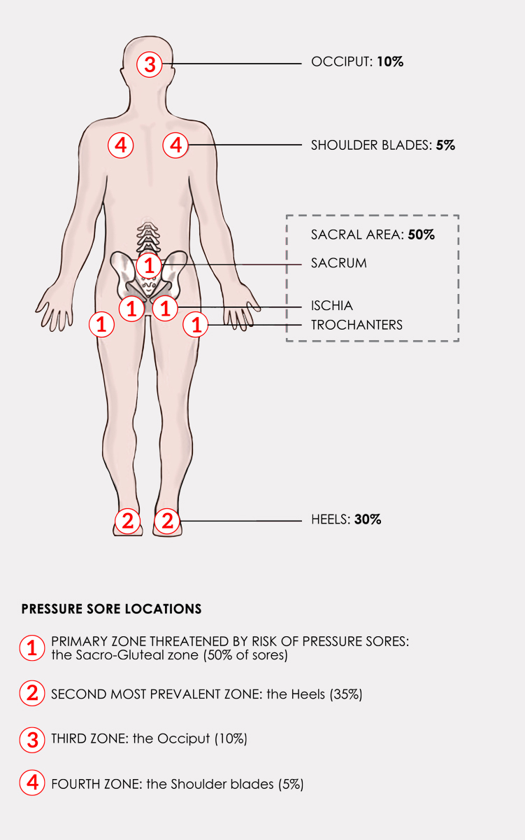 Pelvic positioning cushion - P-Dppnm - Metras - foam / anti-decubitus /  waterproof