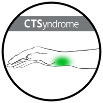 CTSyndrome