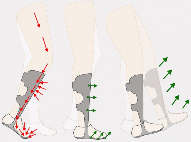 Dynamic orthese for foot and shin bone CARBONAFO code AM-ASS-OS