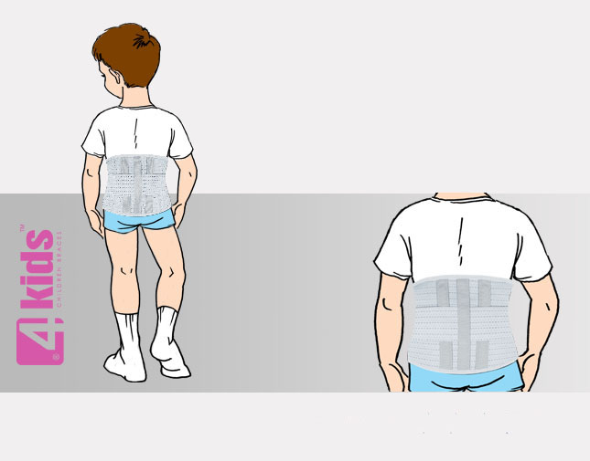 Ортез туловища AR-SO-01