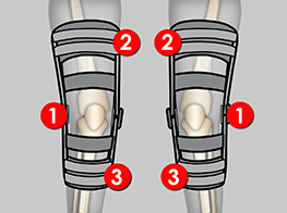 KOŚLAWOŚĆ (VALGUS KNEE)