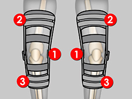 SZPOTAWOŚĆ (VARSUS KNEE)