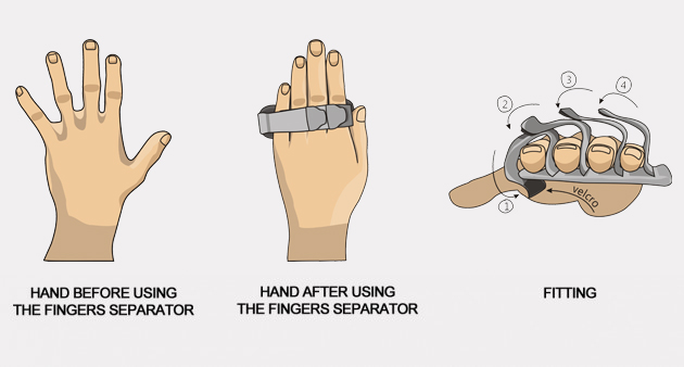 Neurological fingers separator