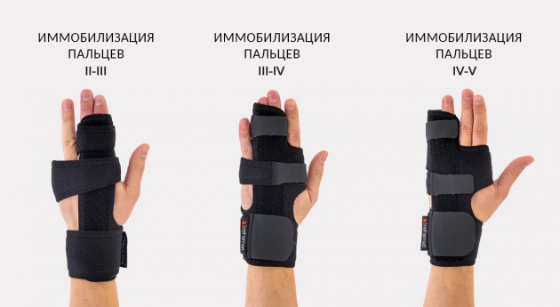 Ортезы при переломе пятой пястной кости