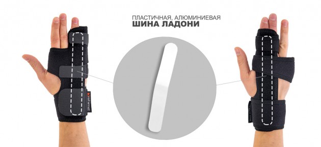Ортезы при переломе пятой пястной кости