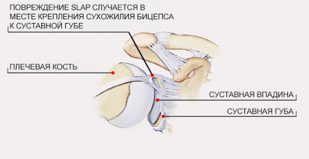 Ортез верхней конечности AM-AO-KG-02 CLEVER 2 ROTATOR